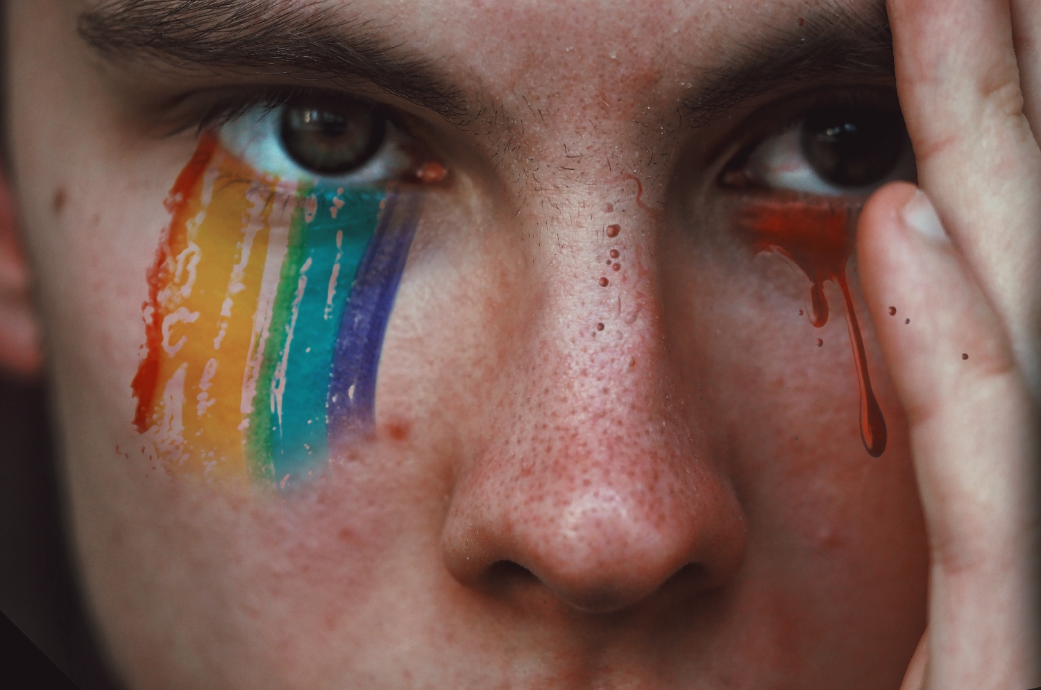 Homofobie: Co je to a jaké jsou její druhy? 